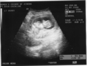 Hazel Ultrasound Pictures
